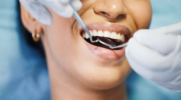 Best Broken or Chipped Tooth Repair in Howland Center, OH